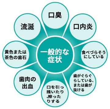 歯周病の一般的な兆候